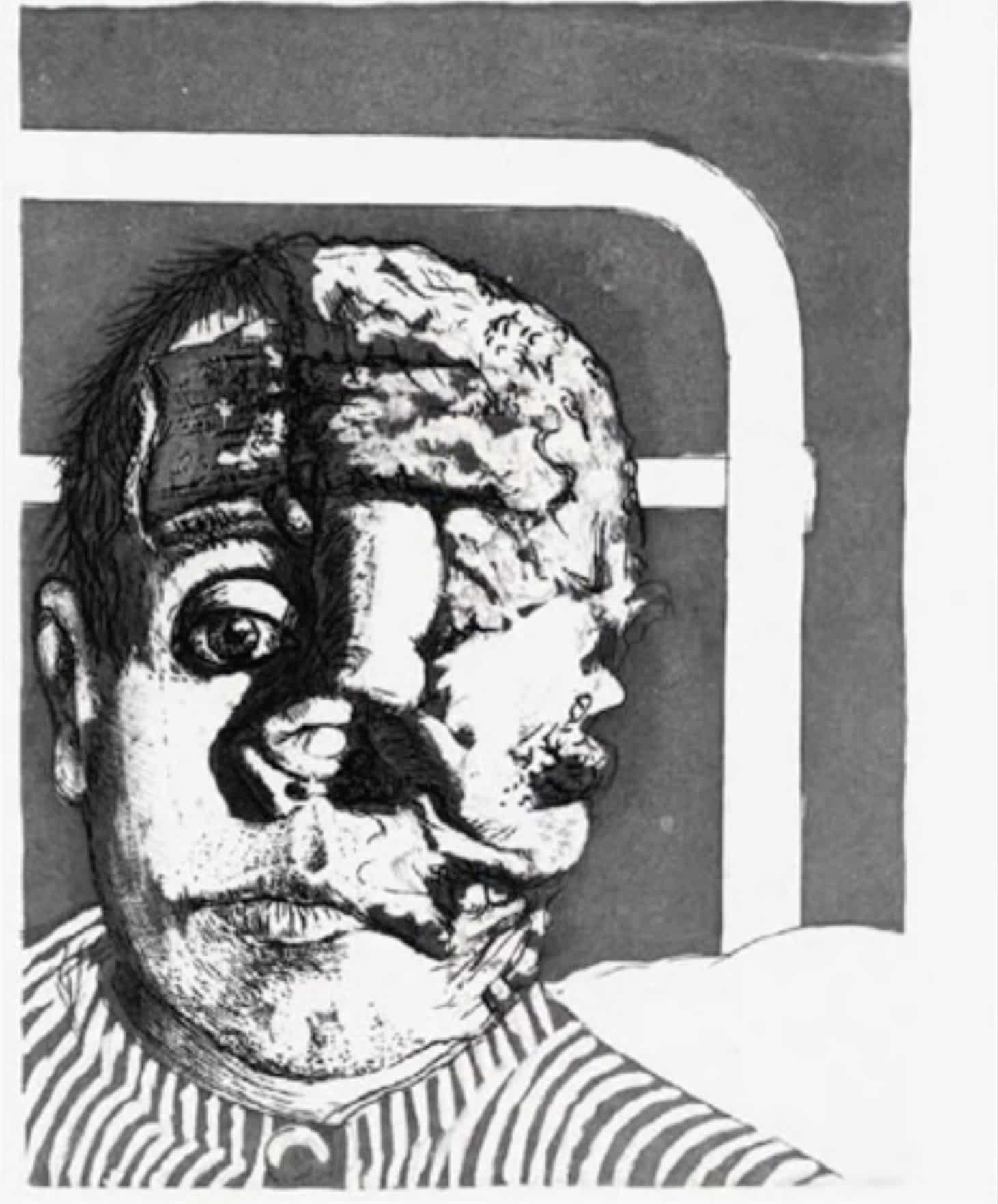 Der Krieg (The War), Otto Dix, 1924 