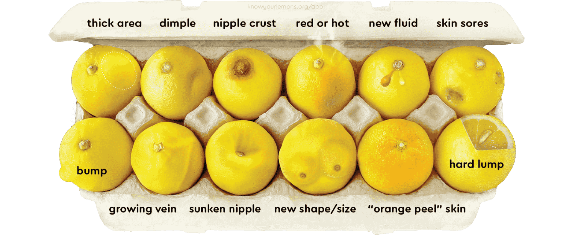#KnowYourLemons, Social Campaign, Know your lemons Foundation, 2019